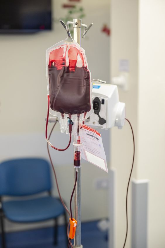 iron infusion
